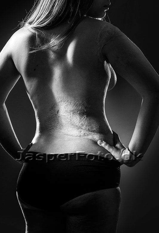 Fotografering af forsikringsskader - copyright jasperfoto.dk